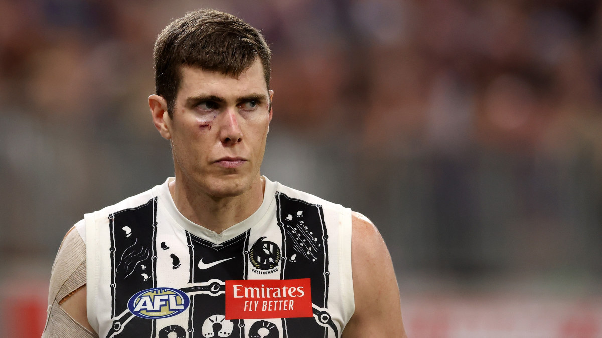 Collingwood, Mason Cox, injury, Kane Cornes, Sam McClure, Footy Classified, Darcy Cameron, Nathan Kreuger