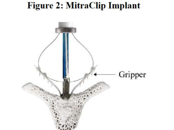 From Dr. Oz to heart valves: A tiny device charted a contentious path through the FDA