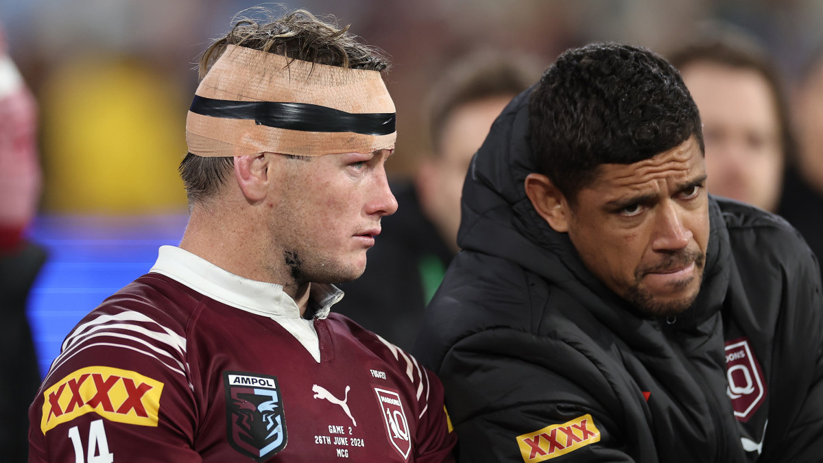 Harry Grant sternum injury; Phil Gould floats Queensland Maroons changes